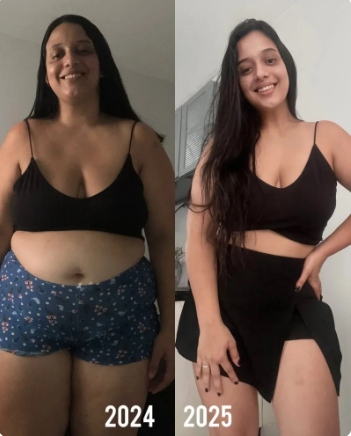 Antes e Depois 4